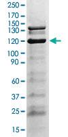 Anti-JAK2 Rabbit Polyclonal Antibody