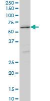 Anti-STK38 Mouse Monoclonal Antibody [clone: 2F6]