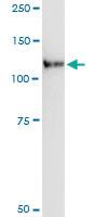 Anti-LLGL2 Polyclonal Antibody Pair