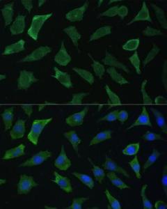 Immunofluorescence analysis of L929 cells using Anti-ECE1 Antibody (A305292) at a dilution of 1:100 (40x lens). DAPI was used to stain the cell nuclei (blue).