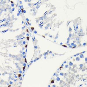 Immunohistochemistry analysis of paraffin-embedded rat testis using Anti-SOX9 Antibody [ARC0190] (A306215) at a dilution of 1:100 (40x lens). Perform microwave antigen retrieval with 10 mM PBS buffer pH 7.2 before commencing with IHC staining protocol