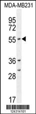 Anti-CYP2A7 Rabbit Polyclonal Antibody