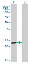 Anti-FXN Mouse Monoclonal Antibody [clone: 3G9]