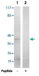 Anti-CDCA7 Rabbit Polyclonal Antibody