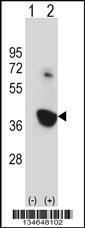 Anti-NEK6 Rabbit Polyclonal Antibody (FITC (Fluorescein Isothiocyanate))