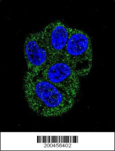 Anti-LTF Mouse Monoclonal Antibody [clone: 119CT80.1.1]