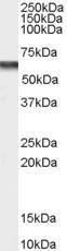 Anti-CACNB4 antibody