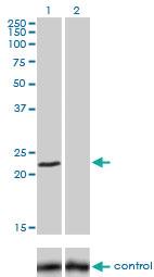 Anti-FXN Mouse Monoclonal Antibody [clone: 3G9]