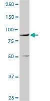 Anti-VCAM1 Rabbit Polyclonal Antibody