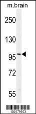 Anti-AR Rabbit Polyclonal Antibody