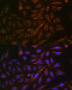 Immunofluorescence analysis of U-2 OS cells using Anti-Cellubrevin Antibody [ARC1312] (A307871) at a dilution of 1:100 (40x lens). DAPI was used to stain the cell nuclei (blue).