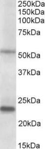 Anti-MMP3 Antibody (A85067) (02 µg/ml) staining of Human Prostate lysate (35 µg protein in RIPA buffer) Primary incubation was 1 hour Detected by chemiluminescence