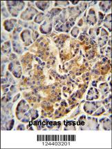 Anti-PRSS3 Rabbit Polyclonal Antibody