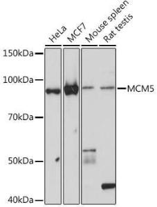 Western blot analysis of extracts of various cell lines, using Anti-MCM5 Antibody [ARC1239] (A305293) at 1:1,000 dilution. The secondary antibody was Goat Anti-Rabbit IgG H&L Antibody (HRP) at 1:10,000 dilution.