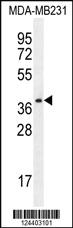 Anti-PRSS3 Rabbit Polyclonal Antibody