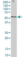 Anti-STK38 Mouse Monoclonal Antibody [clone: 2F6]