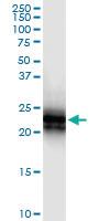 Anti-TNFRSF17 Polyclonal Antibody Pair