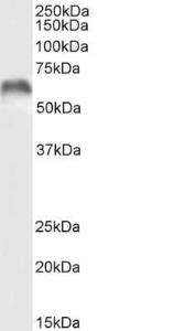 Anti-MMP3 Antibody (A85067) (03 µg/ml) staining of Mouse Eye lysate (35 µg protein in RIPA buffer) Primary incubation was 1 hour Detected by chemiluminescence