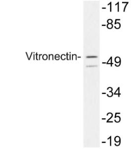 Western blot analysis of lysate from 293 cells using Anti-Vitronectin Antibody