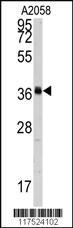 Anti-POLR1C Rabbit Polyclonal Antibody