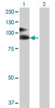 Anti-VCAM1 Rabbit Polyclonal Antibody