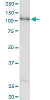 Anti-TAOK3 Polyclonal Antibody Pair