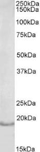 Anti-IL17A Antibody (A85068) (1 µg/ml) staining of Human Lymph Node lysate (35 µg protein in RIPA buffer). Primary incubation was 1 hour. Detected by chemiluminescence