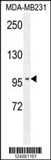 Anti-ST7 Rabbit Polyclonal Antibody