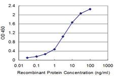 Anti-FXN Mouse Monoclonal Antibody [clone: 5D4]