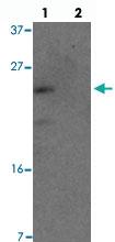 Anti-YPEL1 Rabbit Polyclonal Antibody