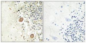 Immunohistochemical analysis of paraffin-embedded human brain using Anti-Chr-A Antibody 1:100 (4°C overnight). The right hand panel represents a negative control, where the antibody was pre-incubated with the immunising peptide.