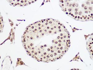 Immunohistochemistry analysis of paraffin-embedded rat testis using Anti-MCM5 Antibody [ARC1239] (A305293) at a dilution of 1:100 (40x lens). Perform microwave antigen retrieval with 10 mM PBS buffer pH 7.2 before commencing with IHC staining protocol.