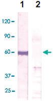 Anti-PTEN Rabbit Polyclonal Antibody