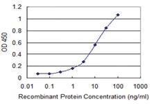 Anti-PPARGC1A Mouse Monoclonal Antibody [clone: 4A8]