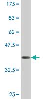 Anti-AMELX Mouse Monoclonal Antibody [clone: 3B5]