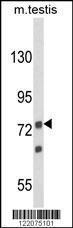 Anti-ANGEL1 Rabbit Polyclonal Antibody (Biotin)