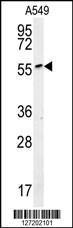 Anti-ALG10B Rabbit Polyclonal Antibody (AP (Alkaline Phosphatase))