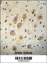 Anti-LOC339742 Rabbit Polyclonal Antibody (FITC (Fluorescein Isothiocyanate))