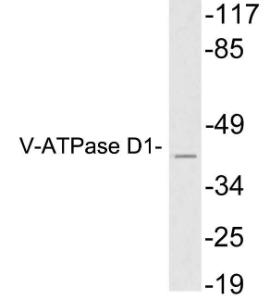 Anti-ATP6V0D1 Rabbit Polyclonal Antibody