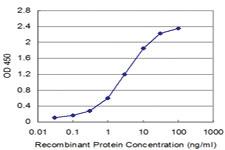 Anti-FXN Mouse Monoclonal Antibody [clone: 5E3]