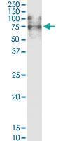 Anti-VCAM1 Rabbit Polyclonal Antibody