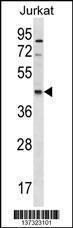 Anti-GDE1 Rabbit Polyclonal Antibody (HRP (Horseradish Peroxidase))