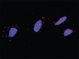 Anti-MAPK13 + MAP3K4 Antibody Pair