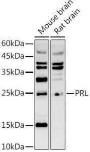 Anti-Prolactin Rabbit Polyclonal Antibody