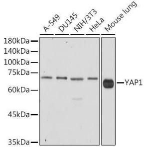 Western blot analysis of extracts of various cell lines, using Anti-YAP1 Antibody (A93149) at 1:1,000 dilution