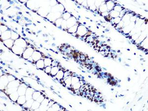 Immunohistochemistry analysis of paraffin-embedded human colon tissue using Anti-MCM5 Antibody [ARC1239] (A305293) at a dilution of 1:100 (40x lens). Perform microwave antigen retrieval with 10 mM PBS buffer pH 7.2 before commencing with IHC staining protocol.