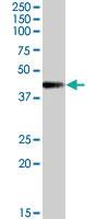 Anti-MC2R Goat Polyclonal Antibody