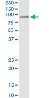 Anti-HAL Antibody Pair