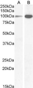 Antibody anti-NMDAR1 100 µg