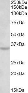 Anti-TSPAN5 Antibody (A85075) (0.3 µg/ml) staining of Mouse Brain lysate (35 µg protein in RIPA buffer). Primary incubation was 1 hour. Detected by chemiluminescence